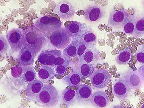 Cytol 100x round cells