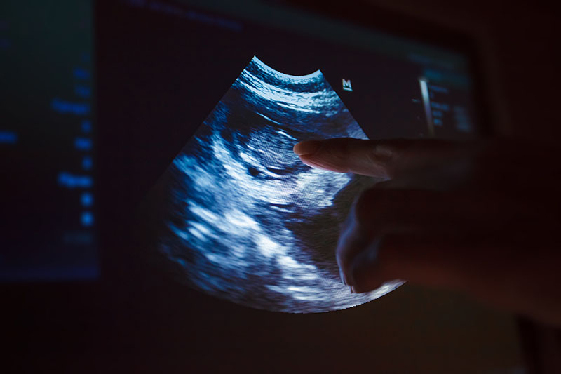 Pointing at ultrasound image